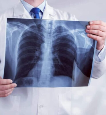 Pneumoftiziologija